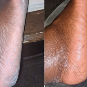 before and afters of customers