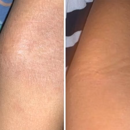 5 year old customer finds relief with Oatmeal Salve | Donata Skinfood